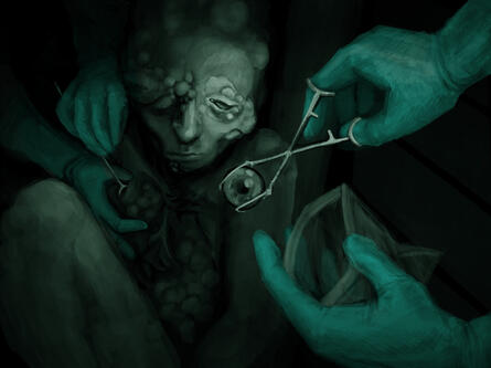 Original: Pearl Seeding